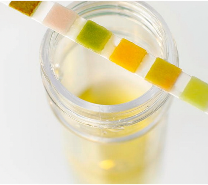 מארז לבדיקות שתן ביתיות ב-60 שניות