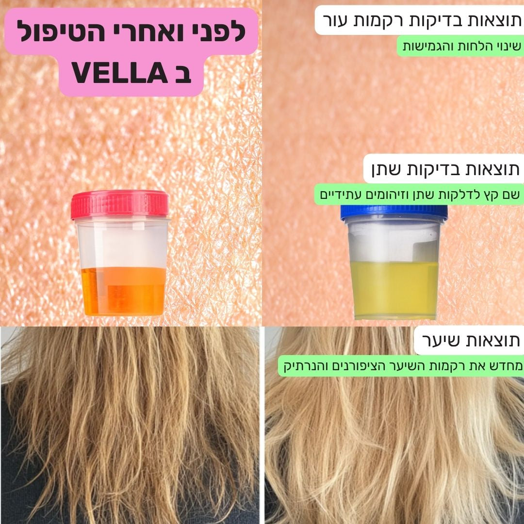 מארז לבדיקות שתן ביתיות ב-60 שניות